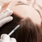 Terapia “Vampir”/PRP