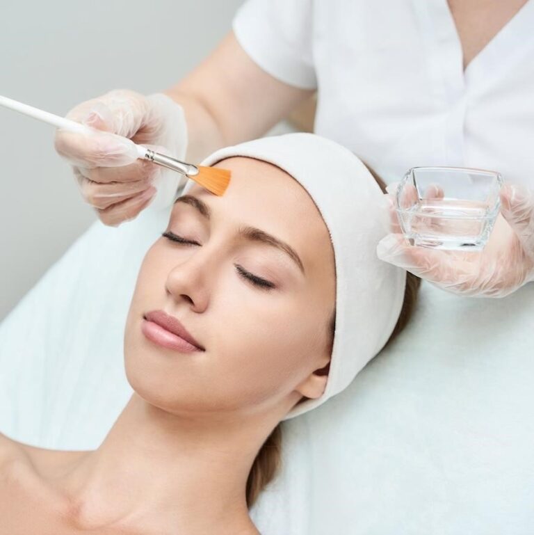 Tratament Peeling Chimic